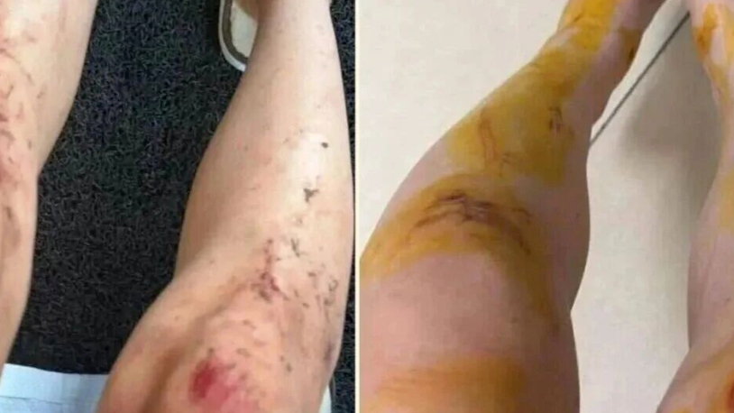 在马来西亚仙本那度假村险遭性侵的中国女游客最新发声