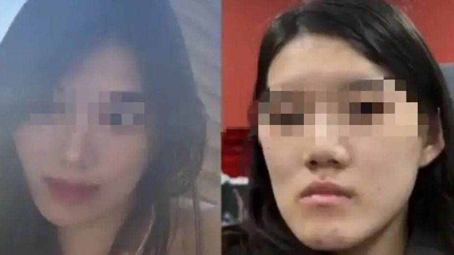 武汉女孩正颌手术被做反，当地卫健委介入