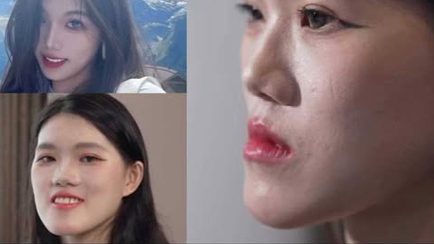 武汉大学口腔医院通报“女子正颌手术事件”：当事医生已停诊