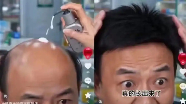 7天长不出头发赔1万元！一洗发水AI广告宣传涉嫌违法被投诉