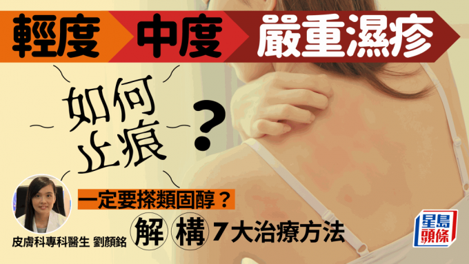 湿疹 湿疹