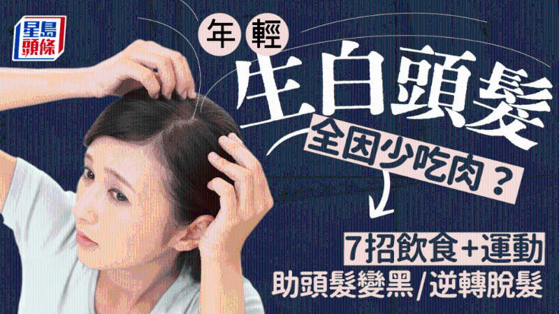 防白发脱发 防白发脱发
