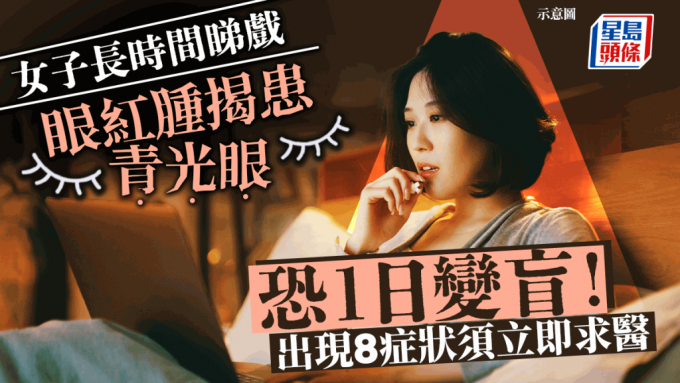 青光眼 青光眼
