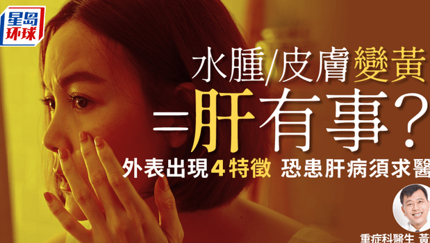 肝病症状 肝病症状