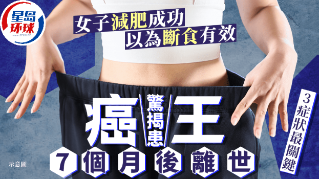 胰脏癌 胰脏癌
