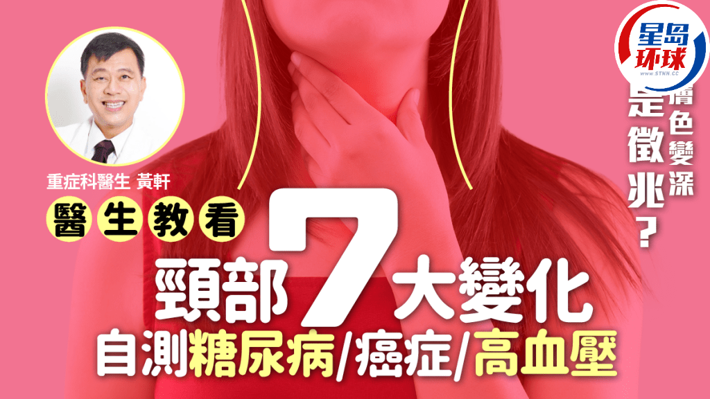 颈部7大变化 颈部7大变化