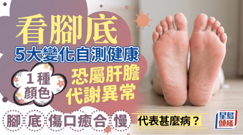 脚底